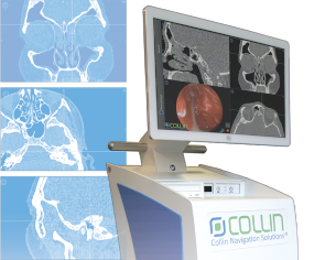 System elektromagnetycznej Neuronawigacjii Laryngologicznej