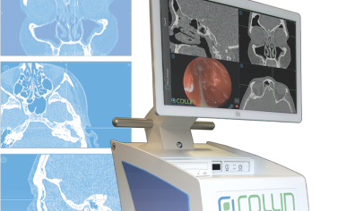 System elektromagnetycznej Neuronawigacji Laryngologicznej
